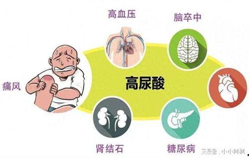 吃凉瓜引发痛风,揭秘夏日饮食中的健康陷阱